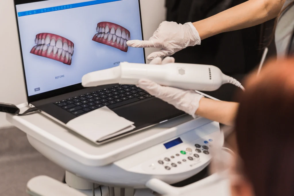 empreinte numerique dentaire Nos technologies Dentistes à Château-Arnoux-Saint-Auban